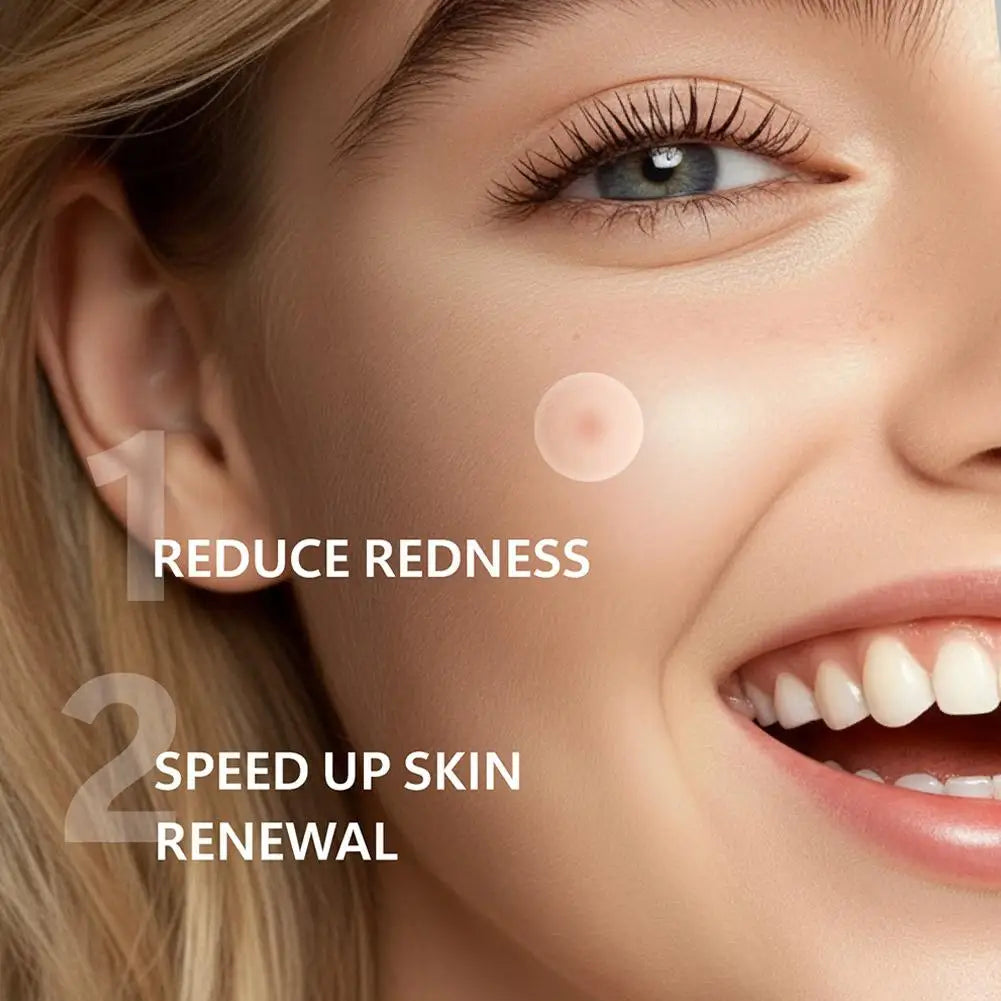 Hydrocolloid Pimple Patch With Micro Needle