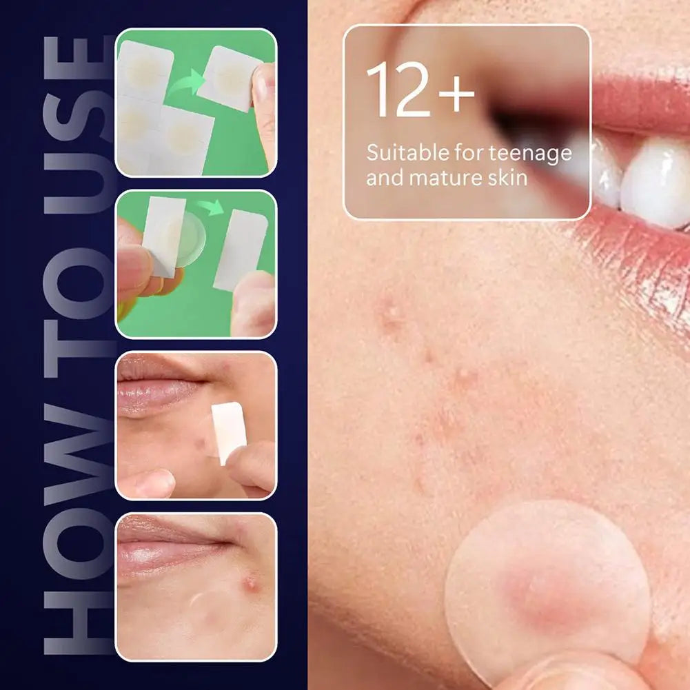 Hydrocolloid Pimple Patch With Micro Needle